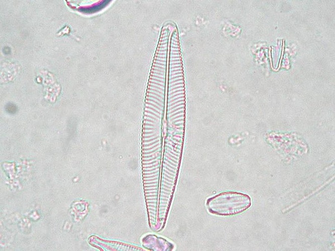 Navicula lanceolata © Kristian Peters <a rel="nofollow" class="external free" href="http://www.korseby.net/outer/flora/algae/index.html">http://www.korseby.net/outer/flora/algae/index.html</a>