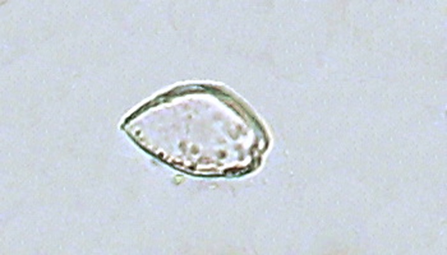 Prorocentrum micans © <a href="//commons.wikimedia.org/wiki/User:%E5%A7%AB%E5%AE%AE%E5%8D%97" title="User:姫宮南">Minami Himemiya</a>