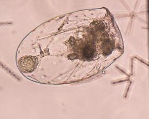 Asplanchna priodonta &copy; <a href="https://de.wikipedia.org/wiki/User:Rajanala83" class="extiw" title="de:User:Rajanala83">Philipp trummer</a>