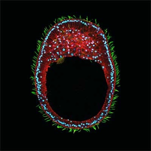 Clytia hemisphaerica © Tsuyoshi Momose