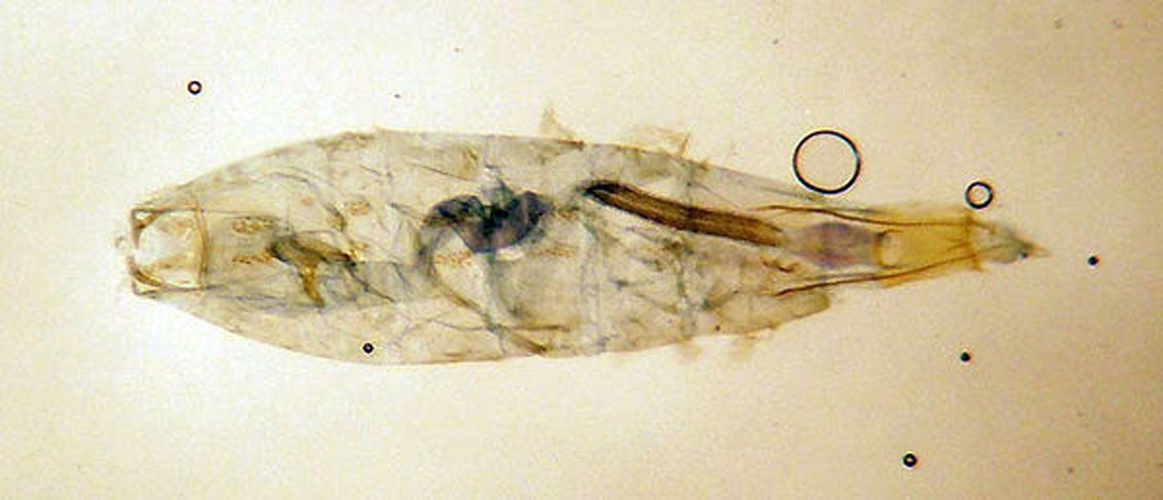 Coleophora glaucicolella © SIP Haapala