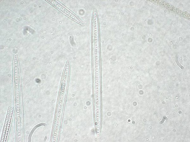 Bacillaria paxillifer &copy; Kristian Peters <a rel="nofollow" class="external free" href="http://www.korseby.net/outer/flora/algae/index.html">http://www.korseby.net/outer/flora/algae/index.html</a>