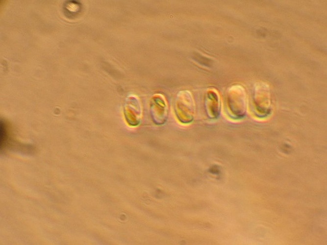 Skeletonema costatum &copy; <a href="//commons.wikimedia.org/w/index.php?title=User:Mgueret&amp;action=edit&amp;redlink=1" class="new" title="User:Mgueret (page does not exist)">Mgueret</a>