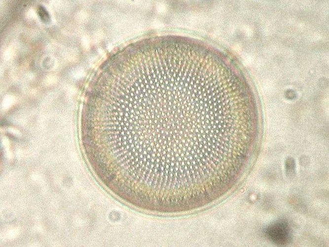 Actinocyclus normanii &copy; Kristian Peters <a rel="nofollow" class="external free" href="http://www.korseby.net/outer/flora/algae/index.html">http://www.korseby.net/outer/flora/algae/index.html</a>