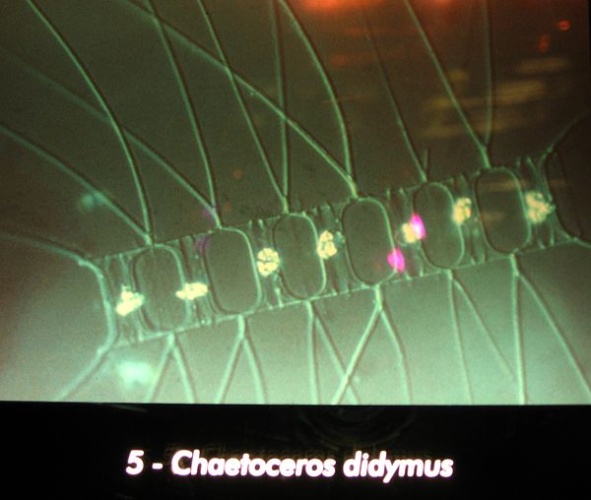 Chaetoceros didymus © <a href="//commons.wikimedia.org/wiki/User:Lin%C3%A91" title="User:Liné1">Liné1</a>