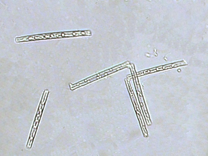 Thalassionema nitzschioides © <a href="//commons.wikimedia.org/wiki/User:%E5%A7%AB%E5%AE%AE%E5%8D%97" title="User:姫宮南">Minami Himemiya</a>