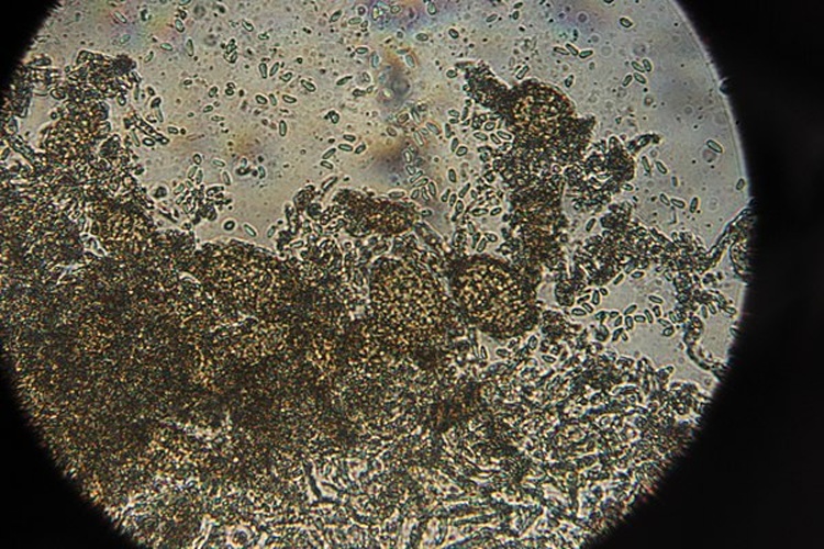 Ampelomyces quisqualis © <a rel="nofollow" class="external text" href="https://www.flickr.com/people/40948266@N04">Björn S...</a>