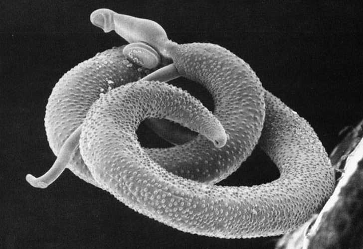 Schistosoma mansoni © The original uploader was <a href="https://en.wikipedia.org/wiki/User:Waisberg" class="extiw" title="wikipedia:User:Waisberg">Waisberg</a> at <a href="https://en.wikipedia.org/wiki/" class="extiw" title="wikipedia:">English Wikipedia</a>.